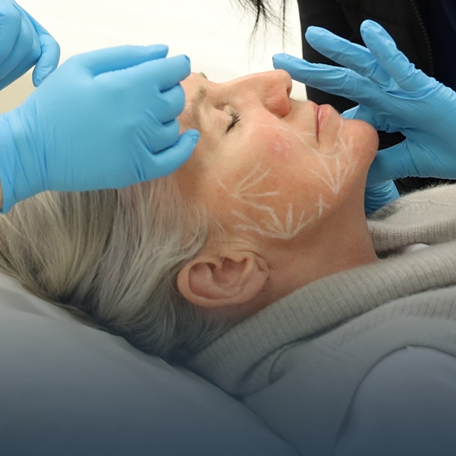 Facial treatment being administered to a patient.